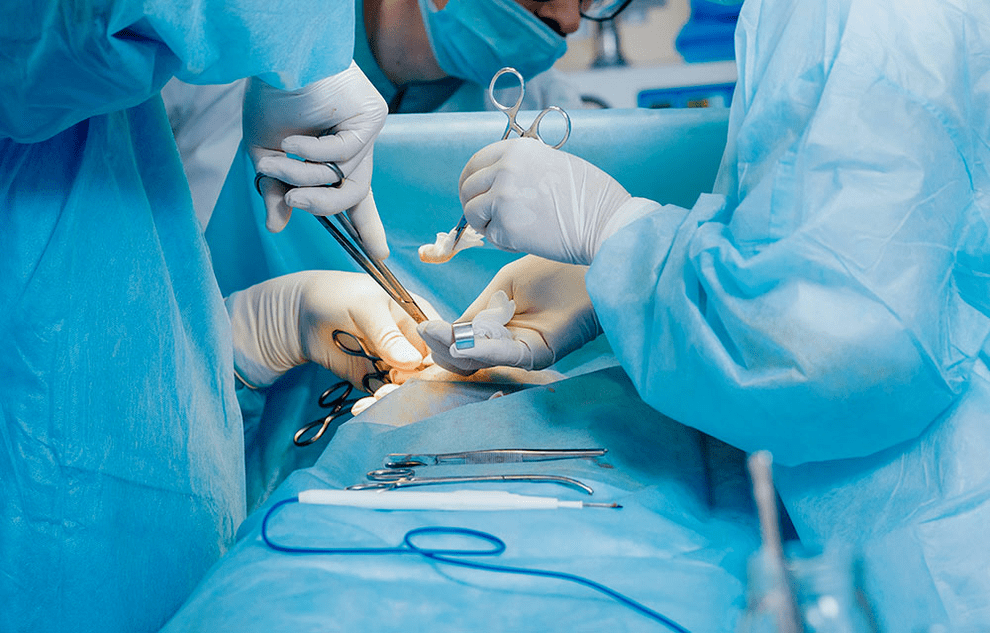 chirurgická metóda na zväčšenie penisu