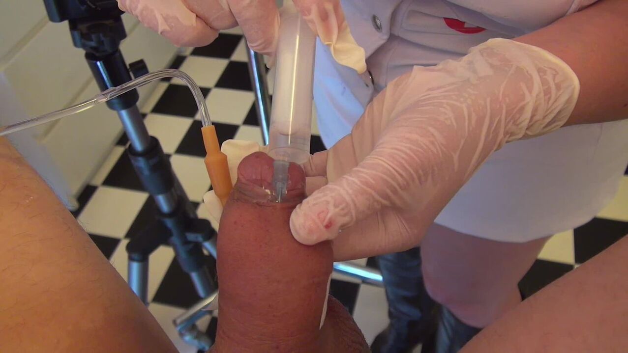 Lipofilling